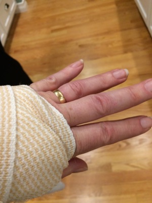 Getting a ring off a swollen finger, Blog